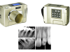 portable-dental-x-ray